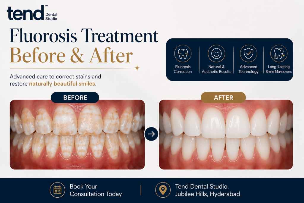 Best Cosmetic Dentist for Fluorosis Teeth Treatment in Hyderabad | Dr. Madhurima Ravipalli